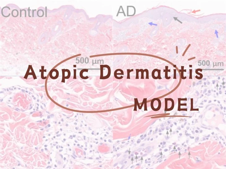 Atopic dermatitis NHP qauv
