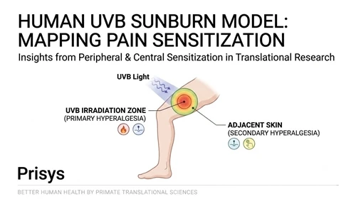 Mob Mechanisms: Tus qauv UVB Sunburn yog ib qho tseem ceeb ntawm kev txhais c...