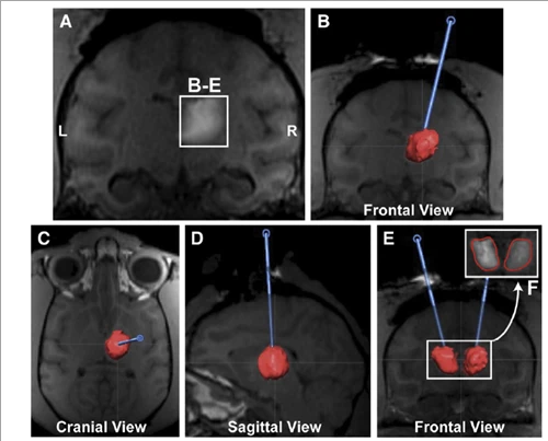MRI-Kev Qhia AAV Kev xa khoom hauv NHP Brain Models Rau CNS Gene Therapy