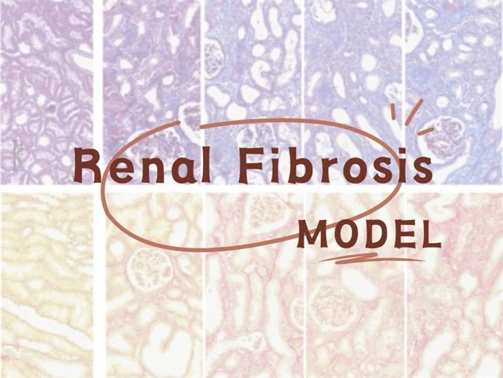 Lub raum Fibrosis Model